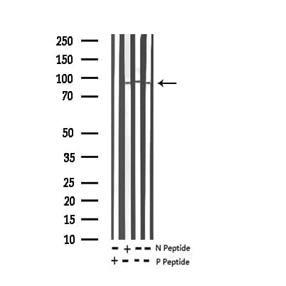 MAPT / Tau Antibody (phospho-Ser262)