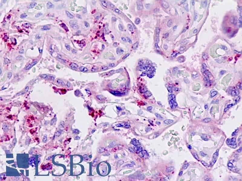 IHC-plus™ LGMN / Legumain Antibody (aa83-112)