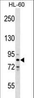 Polyclonal Rabbit anti-Human ZNF224 Antibody (aa127-155, WB)