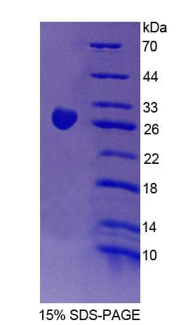 Mouse CHN2 / Chimerin 2 Protein (Recombinant His-T7)