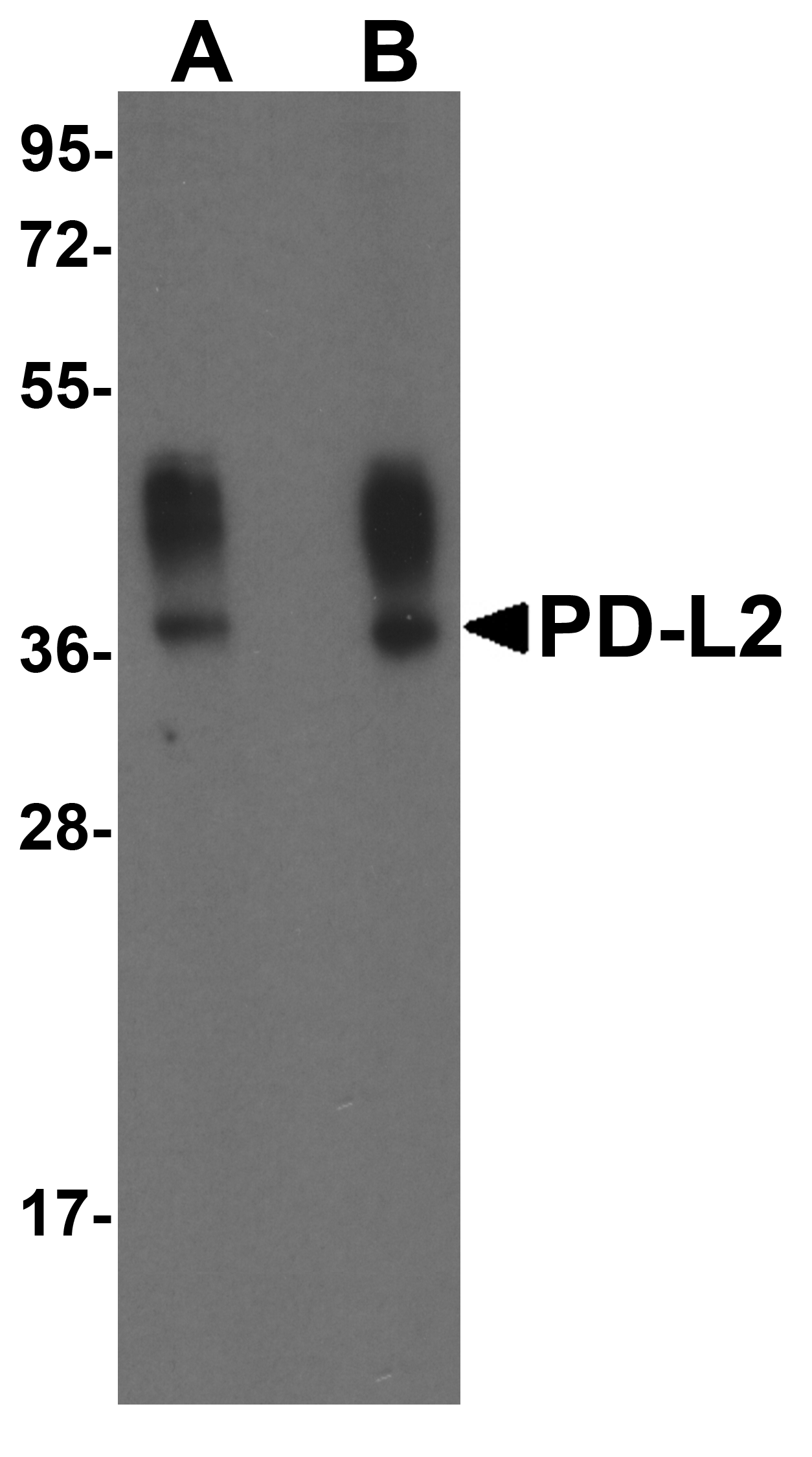 PathPlus™ PD-L2 / PDCD1LG2 / CD273 Antibody (clone 10H6)