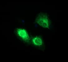 IHC-plus™ CD163 Antibody (clone 2B12)