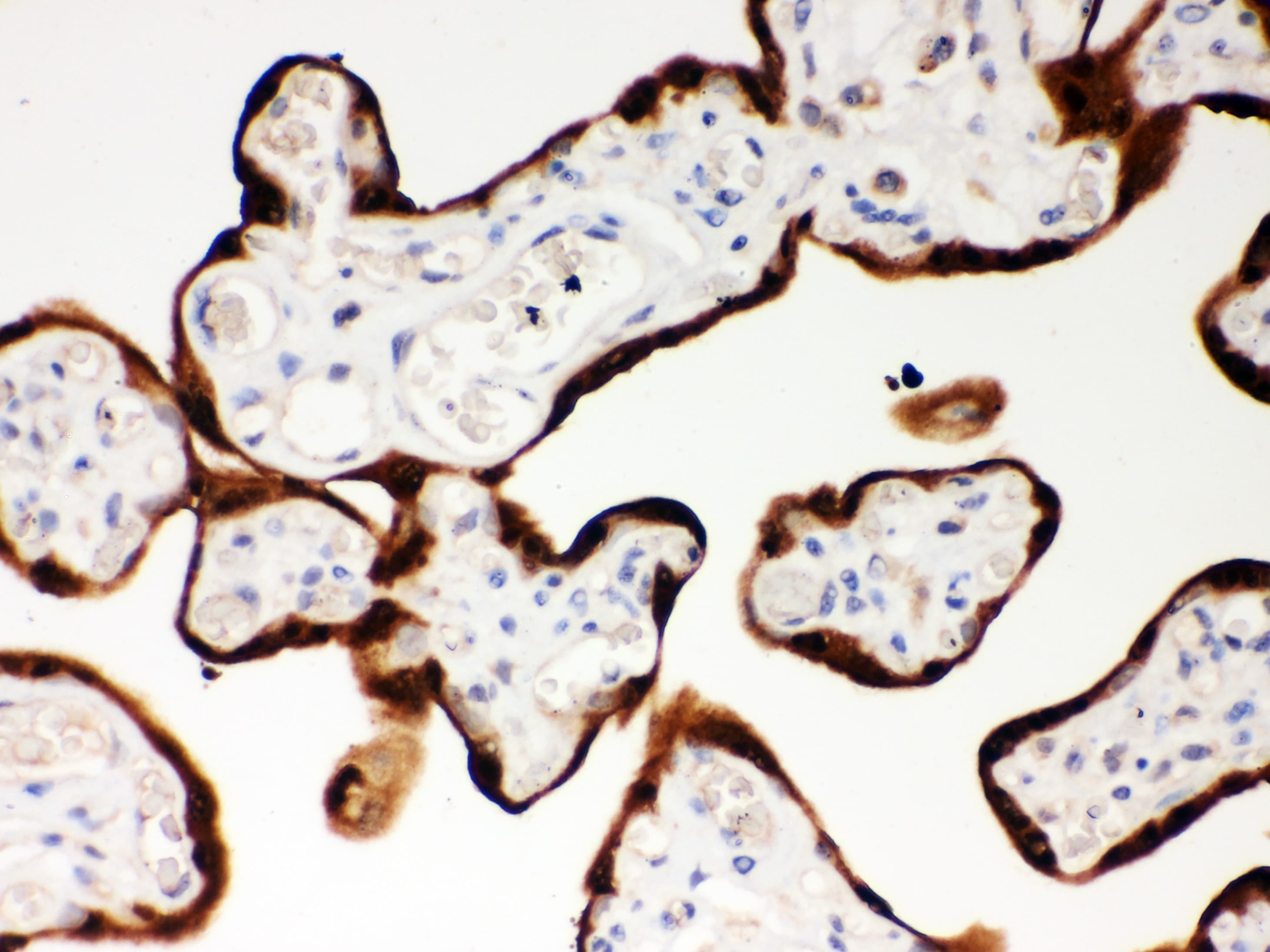 SERPINB2 / PAI-2 Antibody (aa1-180)