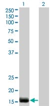EDN2 / Endothelin 2 Antibody (clone 3B4-1C5)