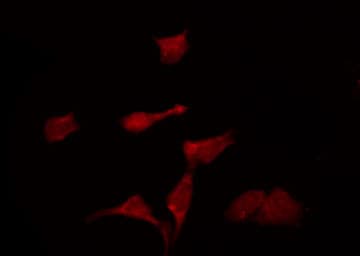 KCNK6 / TWIK-2 Antibody