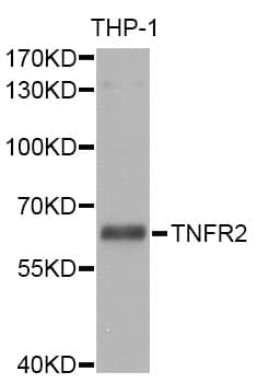 Polyclonal Rabbit anti-Human TNFRSF1B / TNFR2 Antibody (IHC, IF, WB)