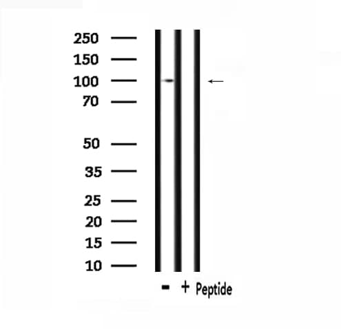 Polyclonal Rabbit anti-Human CDH17 / Cadherin 17 Antibody (aa355-378, IF, WB)