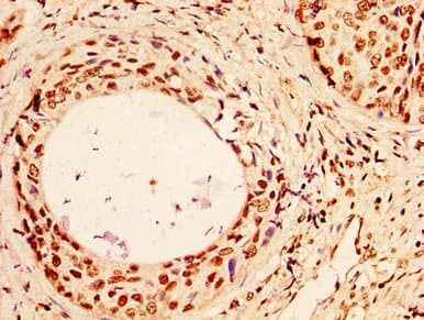 HIST1H1C Antibody
