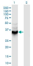 ANXA9 Antibody (clone 5G3)