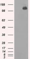 Monoclonal Mouse anti-Human BUB1B / BubR1 Antibody (clone OTI10B7, IHC, IF, WB)