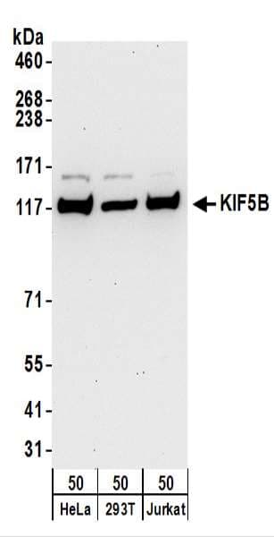 Polyclonal Rabbit anti-Human Kinesin Heavy Chain / KIF5B Antibody (aa913-963, WB)