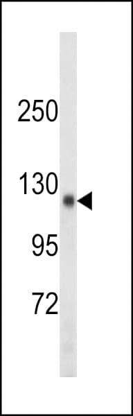 IHC-plus™ Polyclonal Rabbit anti-Human TSHZ1 Antibody (aa656-685, IHC, WB)