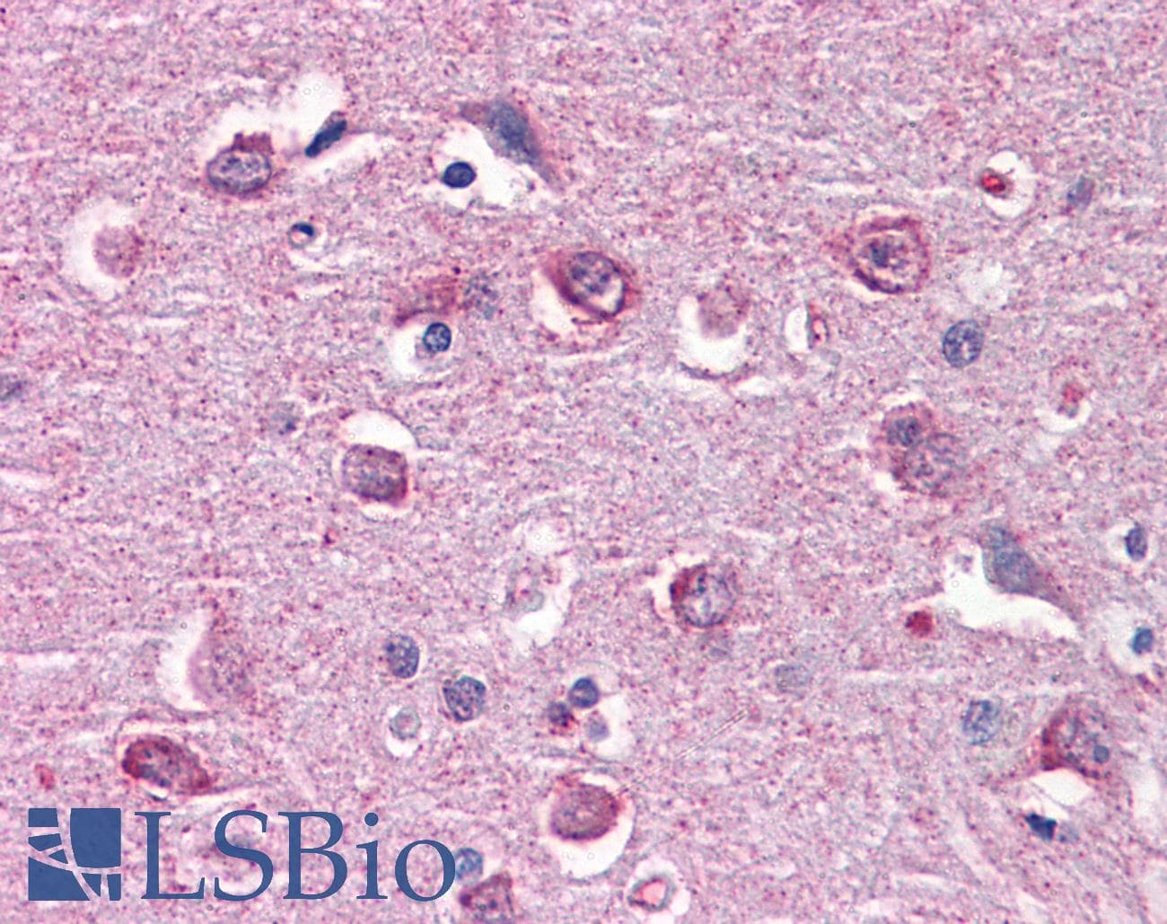 IHC-plus™ Monoclonal Mouse anti-Human CAMK2B / CaMKII Beta Antibody (clone S11, IHC, WB)