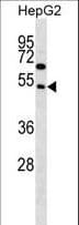 FAM83A Antibody (aa268-295)