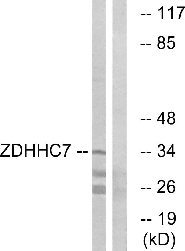 ZDHHC7 Antibody (aa259-308)