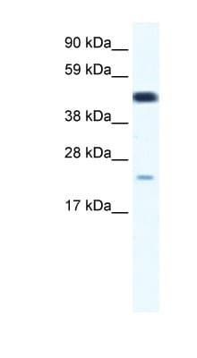 Polyclonal Rabbit anti-Human TCF7 Antibody (aa228-277, IHC, WB)