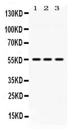 Polyclonal Rabbit anti-Human MPP1 Antibody (WB)