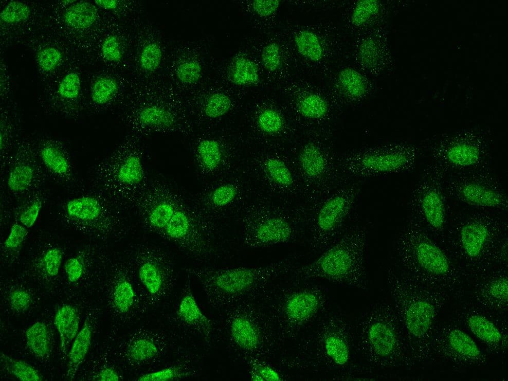 TMEM38A Antibody