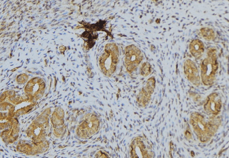 CGA / hCG Alpha Antibody