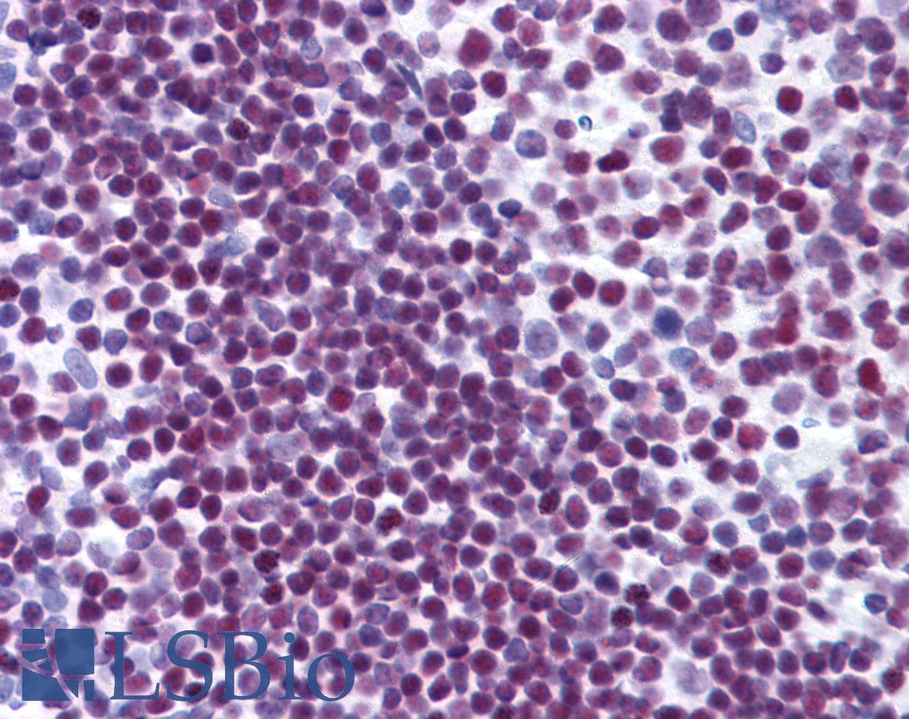 IHC-plus™ Monoclonal Rabbit anti-Human PARP1 Antibody (clone 46D11, Gly623, IHC, IF, WB)
