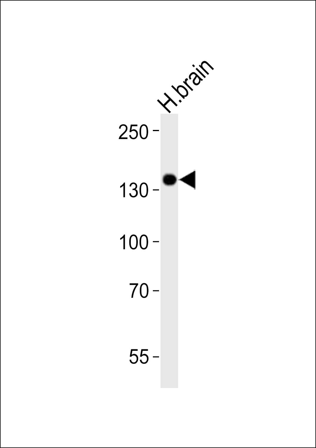 Monoclonal Mouse anti-Mouse NTRK3 / TRKC Antibody (clone 1454CT394.87.35, WB)
