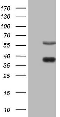 NR1D2 Antibody (aa1-294, clone OTI5C6)