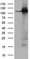 BUB1B / BubR1 Antibody (clone OTI6E3)