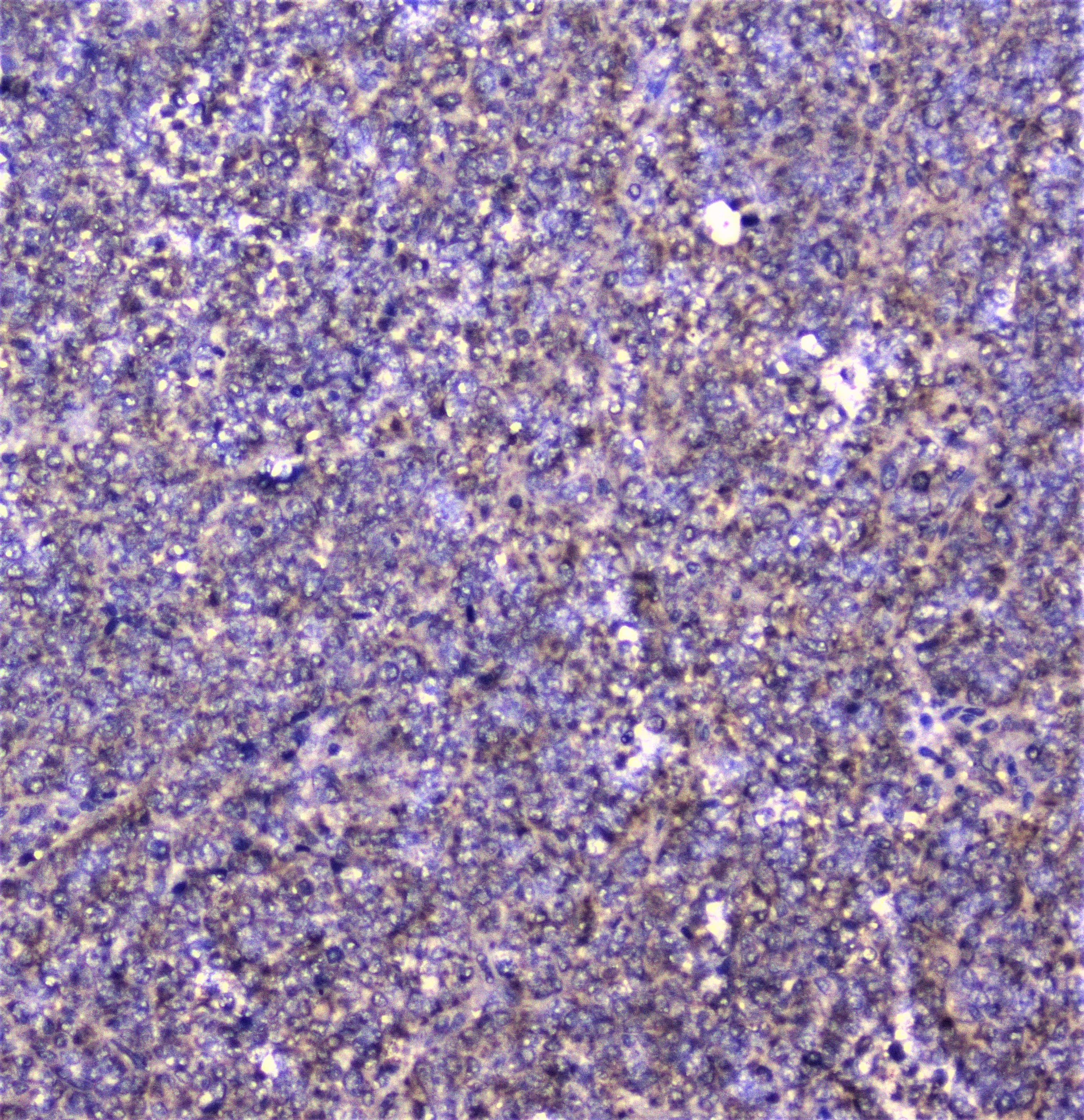 CTTN / Cortactin Antibody