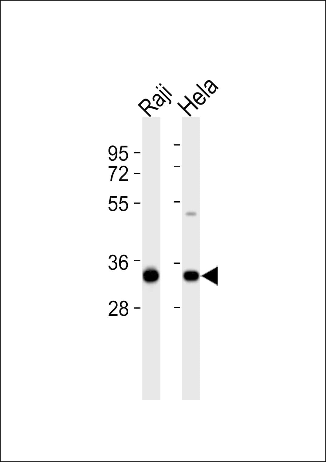 GC1qR / C1QBP Antibody