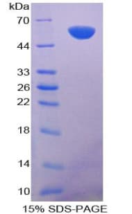 Human AATF Protein (Recombinant His-GST)