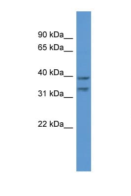 MGC11296 / BRMS1L Antibody (C-Terminus)