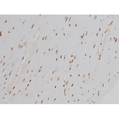 EZR / Ezrin Antibody (phospho-Tyr478)