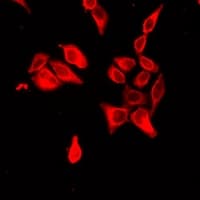 Polyclonal Rabbit anti-Human SLC34A1 / NPT2 Antibody (IF, WB)