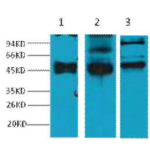 KRT17 / CK17 / Cytokeratin 17 Antibody (clone 10A1)