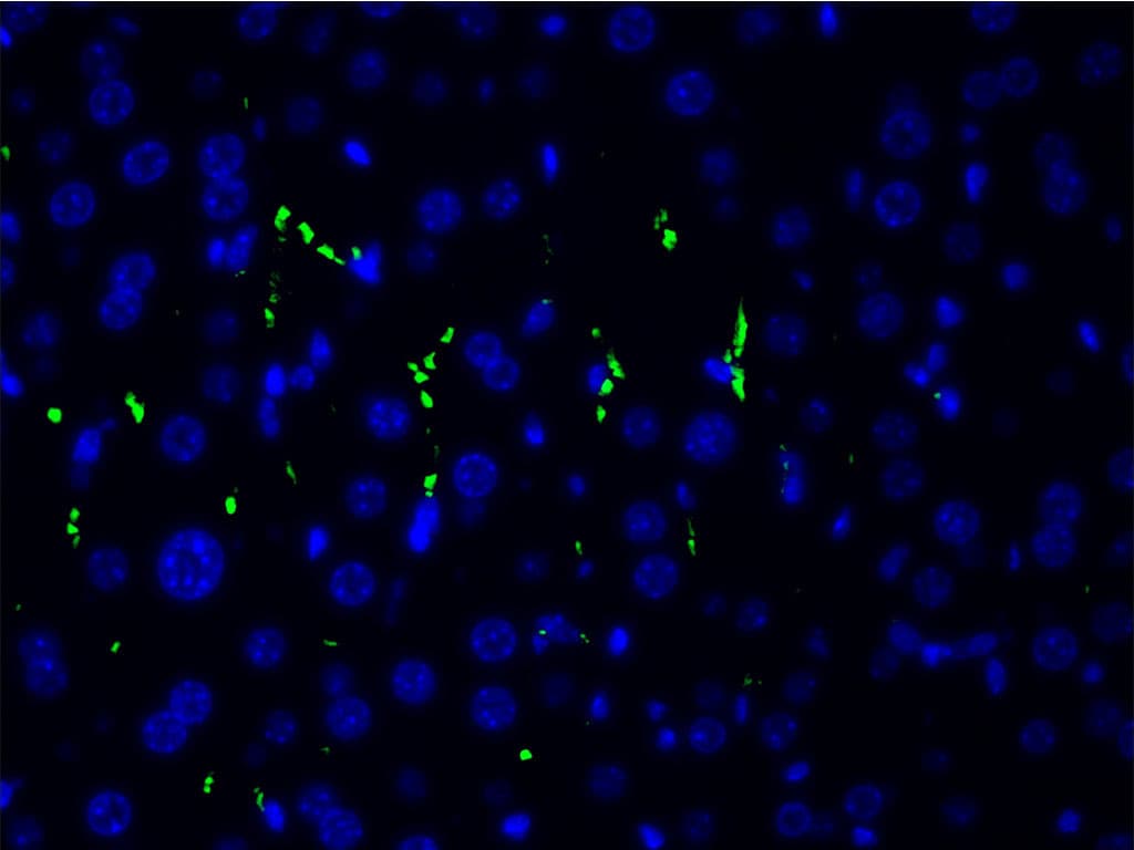 LIMK1 / LIMK Antibody (phospho-Thr508)
