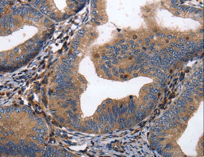 DPYSL4 / CRMP3 Antibody