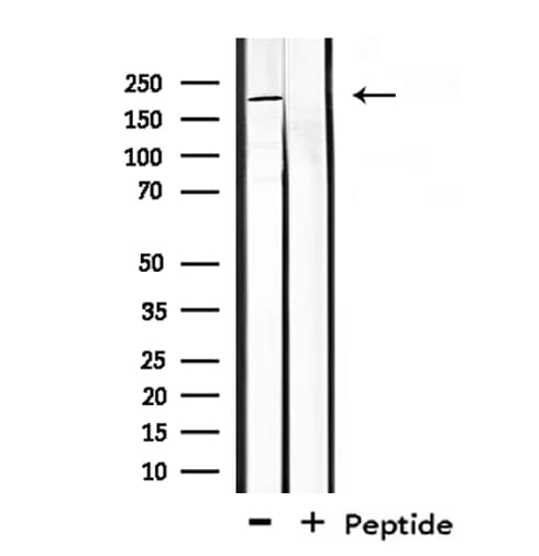 CROCC / Rootletin Antibody