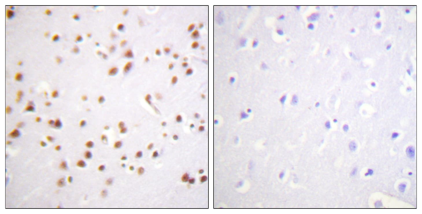 Polyclonal Rabbit anti-Human CTNND1 / p120 Catenin Antibody (aa201-250, IHC, WB)