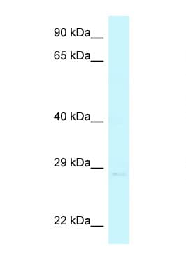 CHMP4A Antibody (C-Terminus)