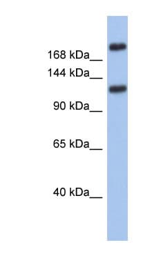 Polyclonal Rabbit anti-Human CACNA1I / Cav3.3 Antibody (aa755-804, IHC, WB)