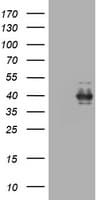 Monoclonal Mouse anti-Human MKI67 / Ki67 Antibody (clone OTI2G2, WB)