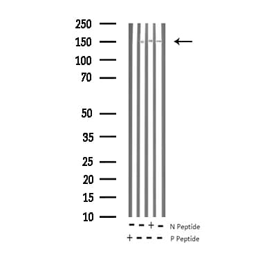 CML / BCR Antibody (phospho-Tyr177)