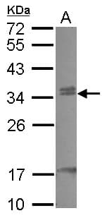 Polyclonal Rabbit anti-Human CBX7 Antibody (WB)