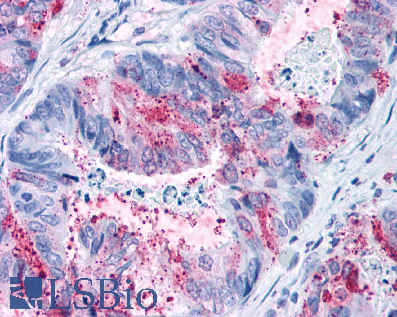 PathPlus™ GPR82 Antibody (Cytoplasmic Domain)