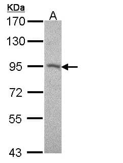 Polyclonal Rabbit anti-Human DSC2 / Desmocollin 2 Antibody (aa480-706, IHC, WB)