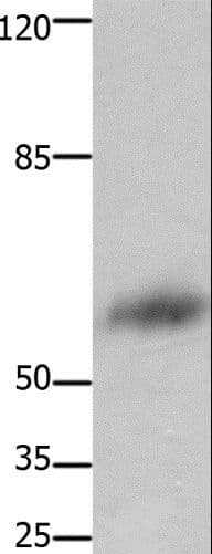 Polyclonal Rabbit anti-Human FOXJ3 Antibody (WB)