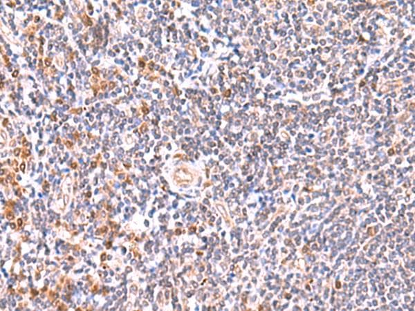 Polyclonal Rabbit anti-Human GMDS / GMD Antibody (IHC)