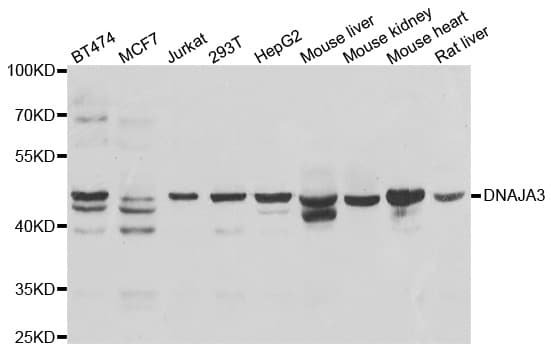 Polyclonal Rabbit anti-Human DNAJA3 / TID1 Antibody (WB)