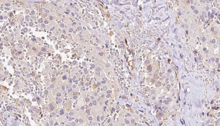 Polyclonal Rabbit anti-Human RPS14 / Ribosomal Protein S14 Antibody (IHC, IF, WB)