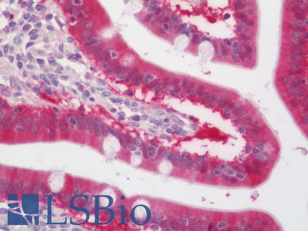 PCK1 Antibody (Biotin)